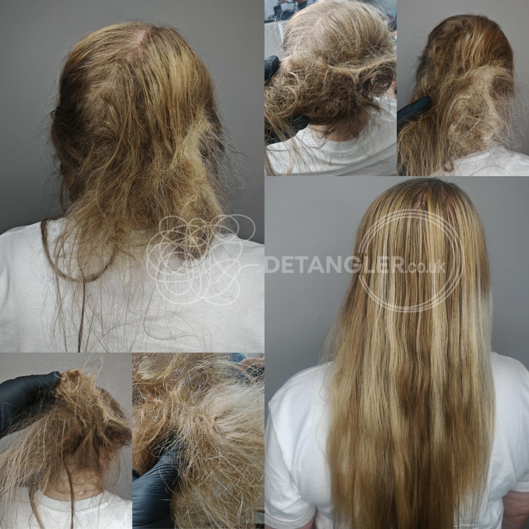 Before and after matted hair transformation