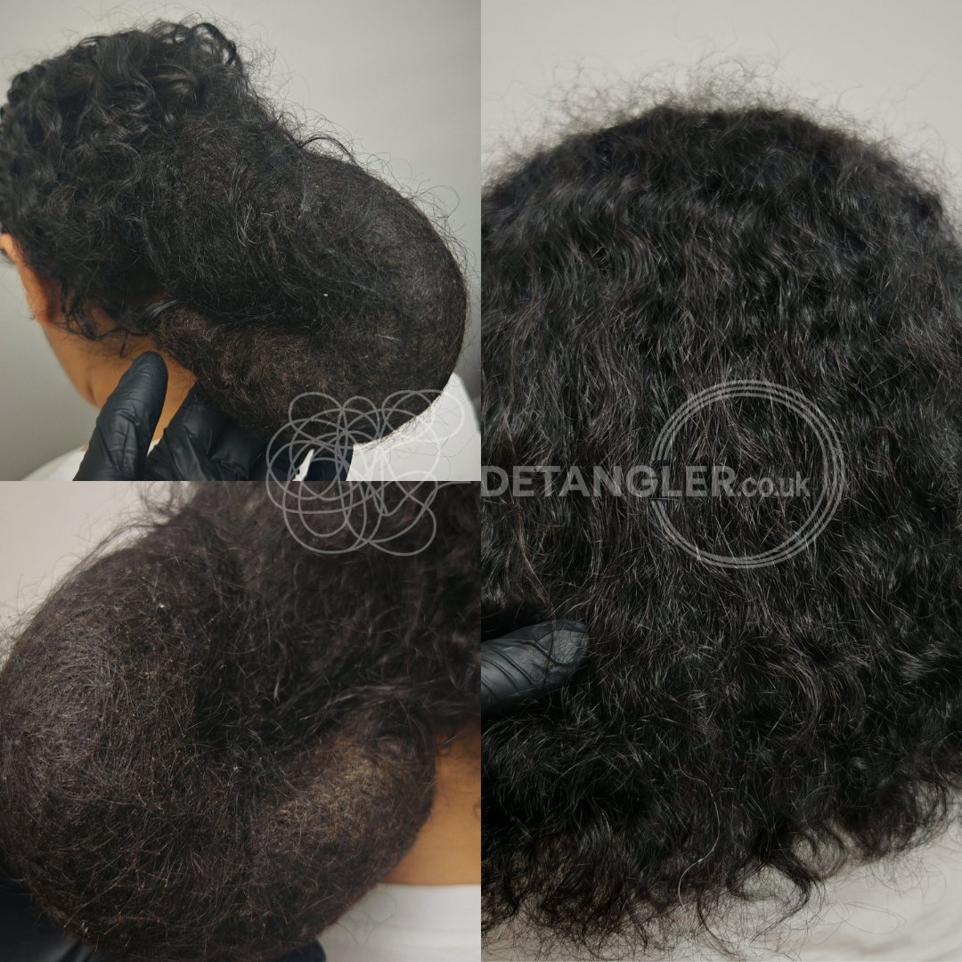 Before and after matted hair transformation